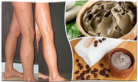 5 natural solutions to successfully combat varicose veins