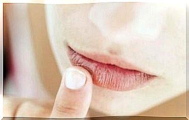 6 home remedies for swollen lips