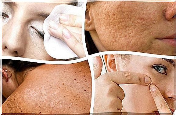 7 habits that harm the health of your skin and that you can avoid