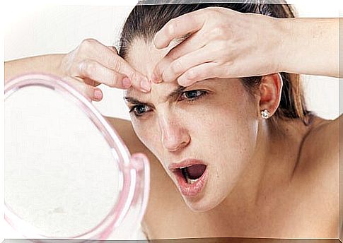 Woman squeezing acne pimple