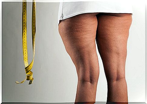 Anti-cellulite treatment