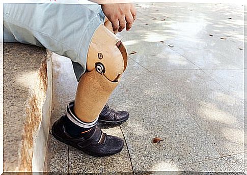 Prosthesis