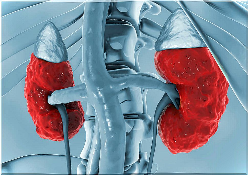 hyperchloremic renal acidosis