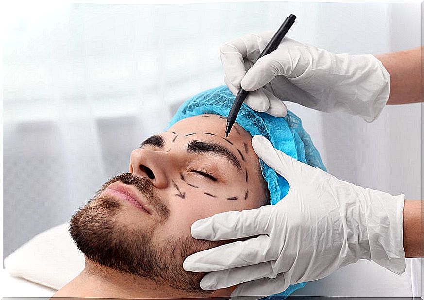 Eyelid surgery man