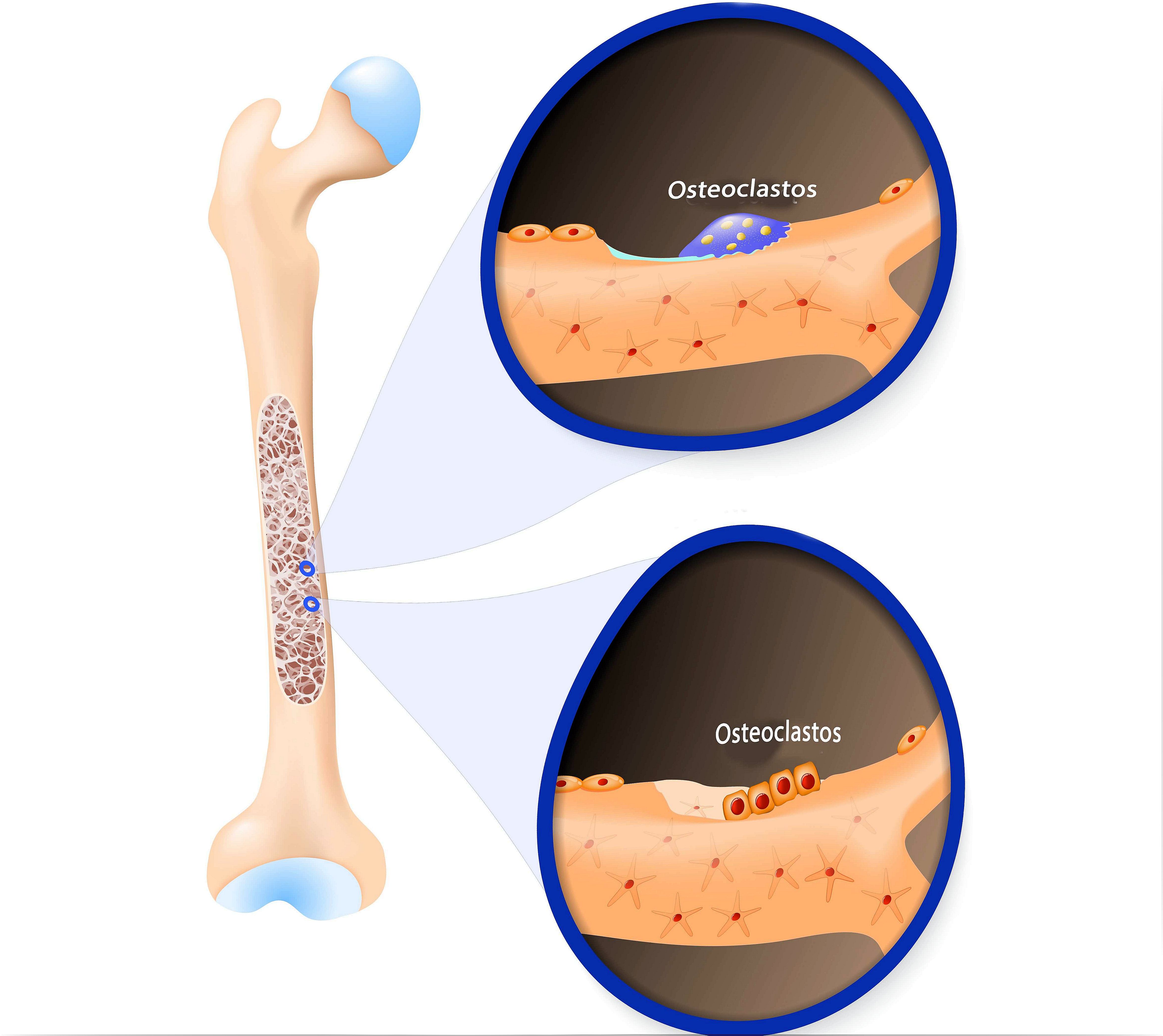 Osteoclasts