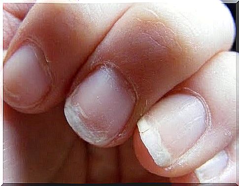 weak nails