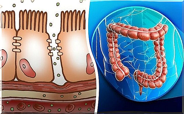 What is a leaky gut and how can it affect your health?