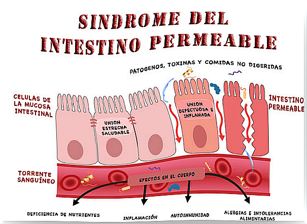 leaky gut1